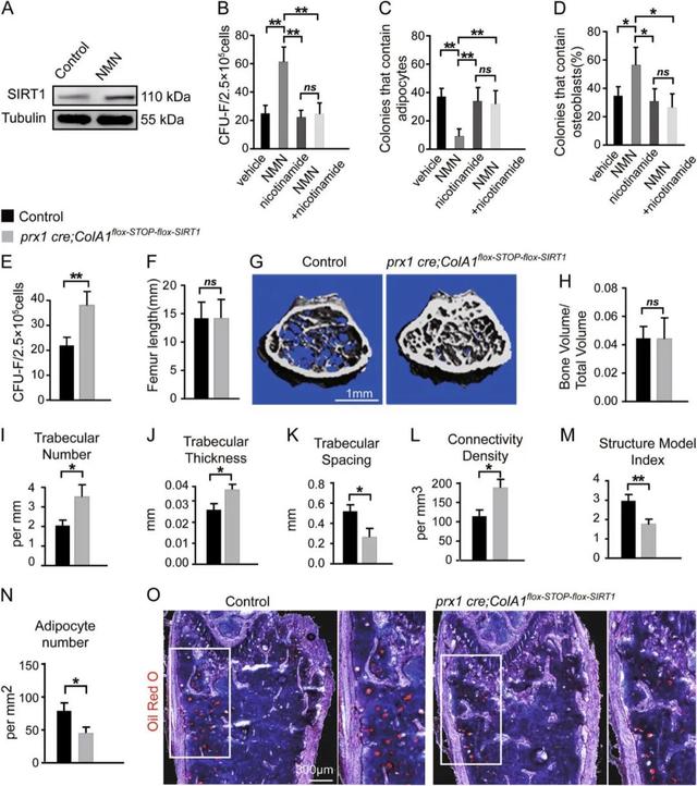 NMN increases the osteogenic activity of BM mesenchymal stem cells through the sirt1 dependent pathway, but reduces fat formation