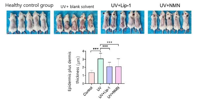 Figure 3: Both NMN and Lip-1 significantly reduced UV-induced skin edema