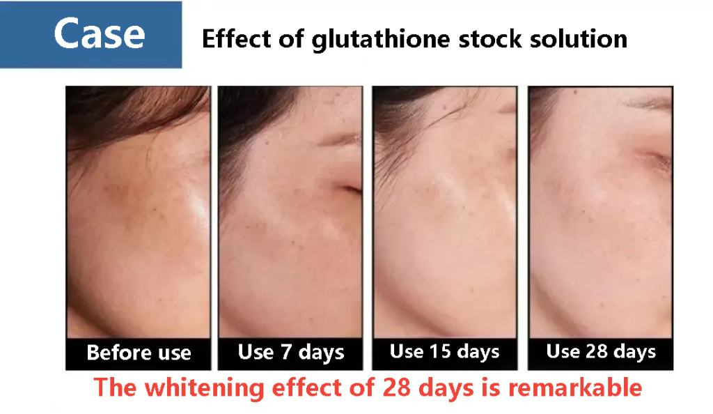 Effect of glutathione stock solution