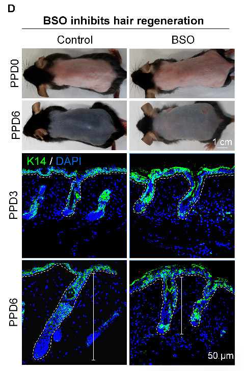 Glutathione (GSH) synthesis inhibitor BSO inhibits hair regeneration