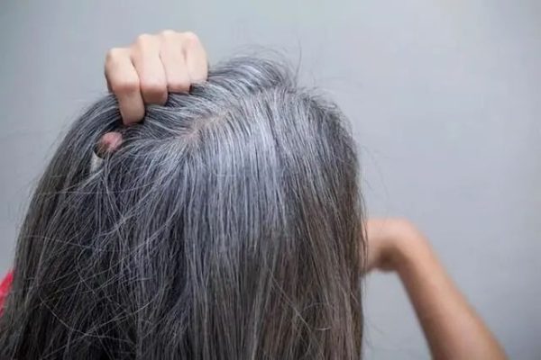 Why can NMN solve the problem of white hair and hair loss