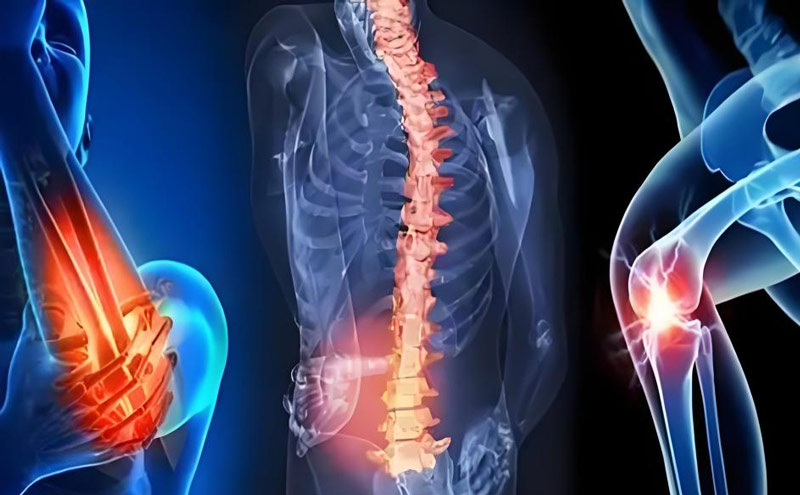 NMN promotes early chondrogenesis after fracture