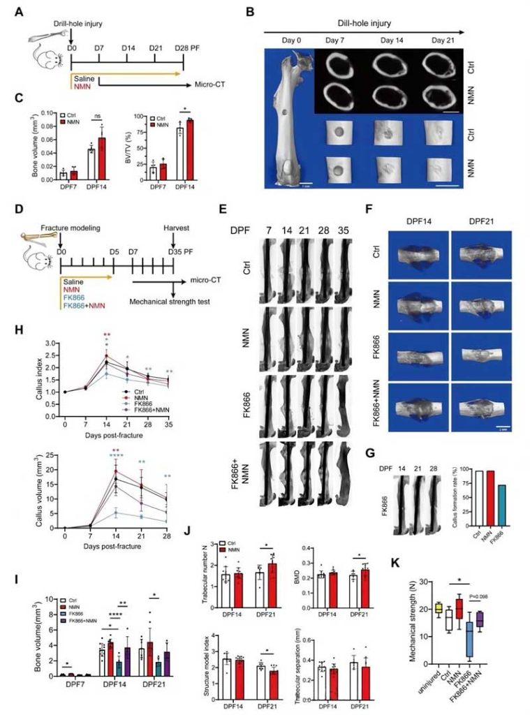 NMN supplementation accelerates bone formation during bone injury healing