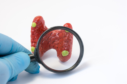 glutathione Reduce inflammatory responses and relieve thyroiditis